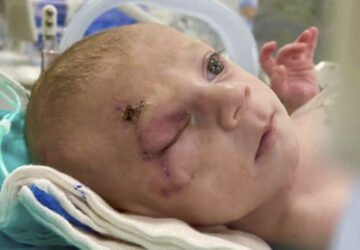 Baby Evacuated From Gaza