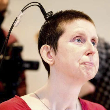 This photo provided by researchers at UCSF and UC Berkeley shows Ann, a participant in a study on speech neuroprostheses, in California in 2023. (Noah Berger/UCSF, UC Berkeley via AP)