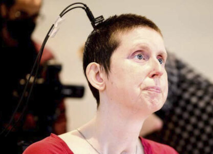 This photo provided by researchers at UCSF and UC Berkeley shows Ann, a participant in a study on speech neuroprostheses, in California in 2023. (Noah Berger/UCSF, UC Berkeley via AP)
