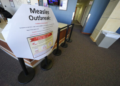 FILE - A measles sign is seen at the Texas Tech University Health Sciences Center, Feb. 25, 2025, in Lubbock, Texas. (AP Photo/Julio Cortez, file)