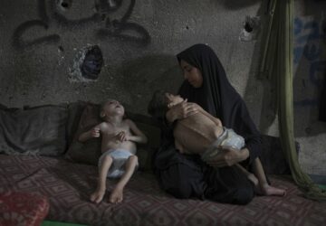 APTOPIX Mideast Wars Gaza Starvation Photo Essay