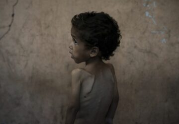 Mideast Wars Gaza Starvation Photo Essay