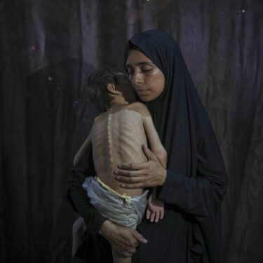 Mideast Wars Gaza Starvation Photo Essay
