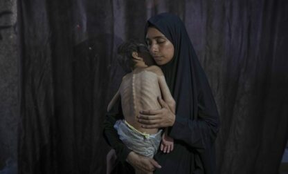 Mideast Wars Gaza Starvation Photo Essay