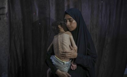 Mideast Wars Gaza Starvation Photo Essay