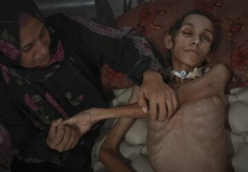 Mideast Wars Gaza Starvation Photo Essay