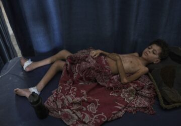 Mideast Wars Gaza Starvation Photo Essay