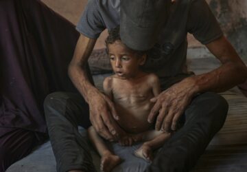 Mideast Wars Gaza Starvation Photo Essay