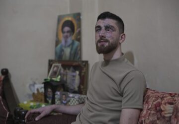 Mideast Wars Lebanon Pager Attack Survivors