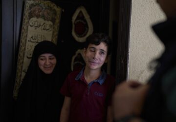 APTOPIX Mideast Wars Lebanon Pager Attack Survivors