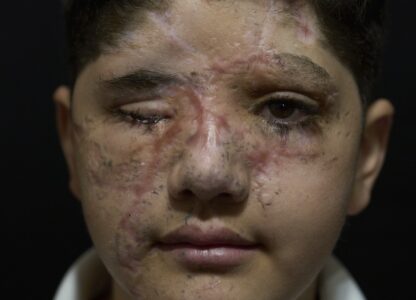 Pictures of the Week Global Photo Gallery