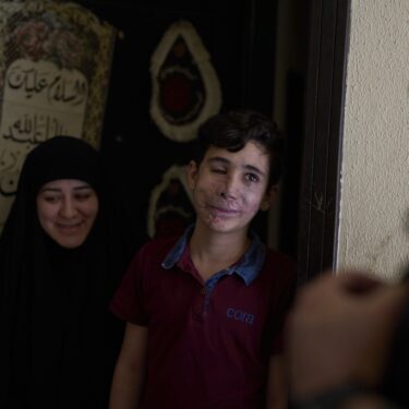 APTOPIX Mideast Wars Lebanon Pager Attack Survivors