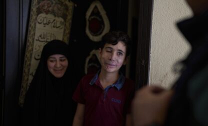 APTOPIX Mideast Wars Lebanon Pager Attack Survivors
