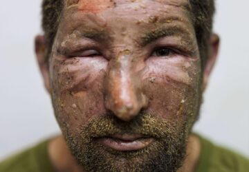 Pictures of the Week Global Photo Gallery