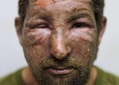 Pictures of the Week Global Photo Gallery