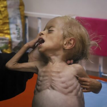 APTOPIX Mideast Wars Gaza Hunger