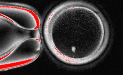 Fertility Research