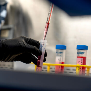 Autoimmunity New Treatments