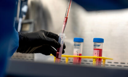 Autoimmunity New Treatments