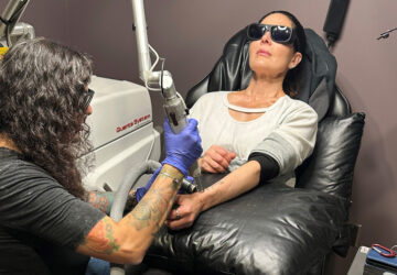 Be Well Tattoo Removal