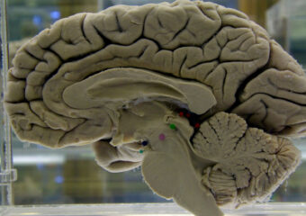 Be Well-Dementia Risk