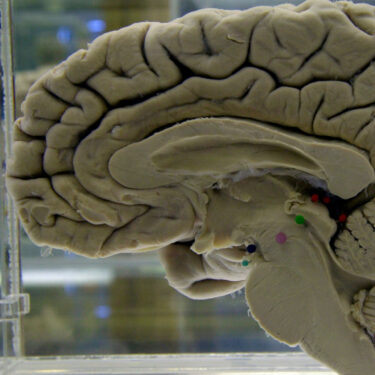 Be Well-Dementia Risk