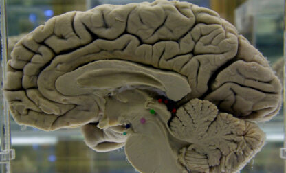 Be Well-Dementia Risk