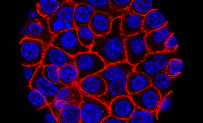 Pancreatic Cancer Drug