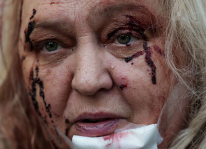 APTOPIX Russia Ukraine War