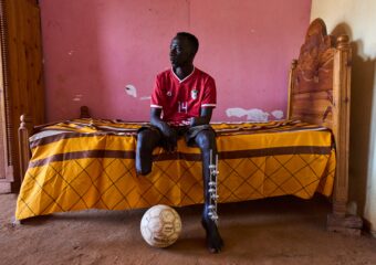 Sudan Scars Of War