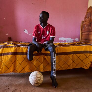Sudan Scars Of War