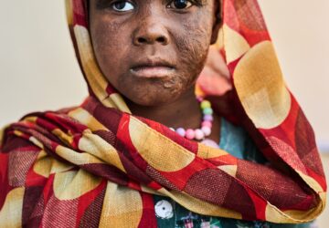 Sudan Scars Of War