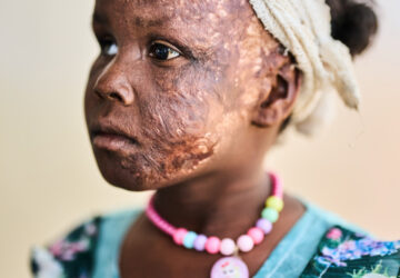 APTOPIX Sudan War Photo Essay