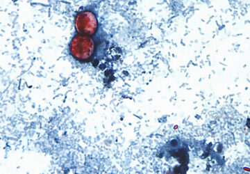 Cyclospora Outbreak History