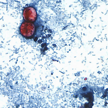 Cyclospora Outbreak History