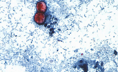 Cyclospora Outbreak History