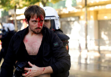 APTOPIX Albania Protest