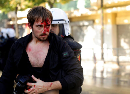 APTOPIX Albania Protest